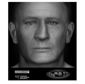 Glenrothes remains facial reconstruction